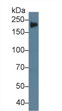 Invitrogen Tenascin C Polyclonal Antibody 20 &mu;L; Unconjugated:Antibodies,