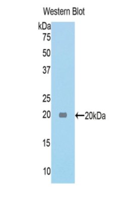 Invitrogen Tenascin C Polyclonal Antibody 20 &mu;L; Unconjugated:Antibodies,