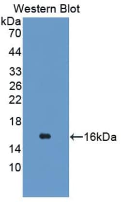 Invitrogen TSPAN1 Polyclonal Antibody 20 &mu;L; Unconjugated:Antibodies,