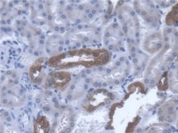 Invitrogen TST Polyclonal Antibody 20 &mu;L; Unconjugated:Antibodies, Polyclonal