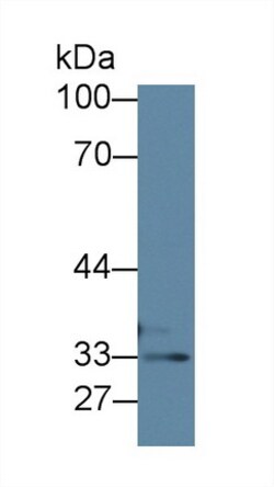 Invitrogen TST Polyclonal Antibody 20 &mu;L; Unconjugated:Antibodies, Polyclonal