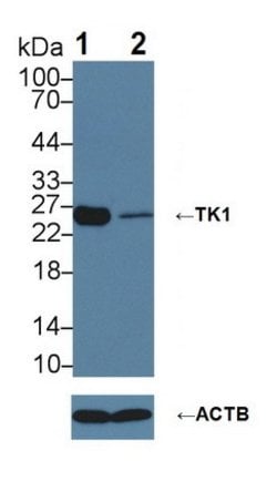 Invitrogen TK1 Polyclonal Antibody 200 &mu;L; Unconjugated:Antibodies,