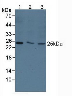 Invitrogen TK1 Polyclonal Antibody 200 &mu;L | Buy Online | Invitrogen&trade; | Fisher Scientific