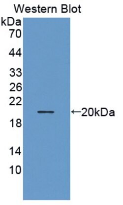 Invitrogen THRSP Polyclonal Antibody:Antibodies:Primary Antibodies