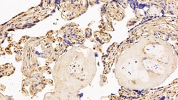 Invitrogen SERPINA7 Polyclonal Antibody 20 &mu;L; Unconjugated:Antibodies,
