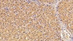 Invitrogen SERPINA7 Polyclonal Antibody 20 &mu;L; Unconjugated:Antibodies,