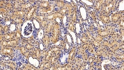 Invitrogen SERPINA7 Polyclonal Antibody 20 &mu;L; Unconjugated:Antibodies,