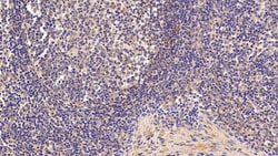 Invitrogen SERPINA7 Polyclonal Antibody 20 &mu;L; Unconjugated:Antibodies,