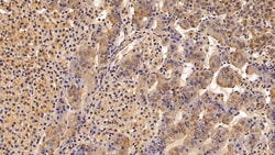 Invitrogen SERPINA7 Polyclonal Antibody 20 &mu;L; Unconjugated:Antibodies,