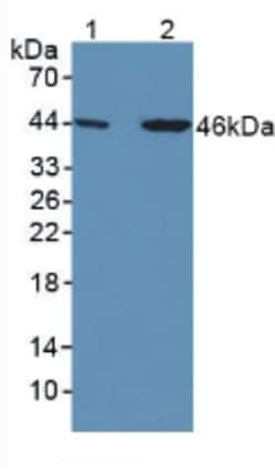 Invitrogen SERPINA7 Polyclonal Antibody 20 &mu;L; Unconjugated:Antibodies,