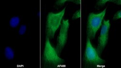 Invitrogen TL1A Polyclonal Antibody 200 &mu;L; Unconjugated:Antibodies,