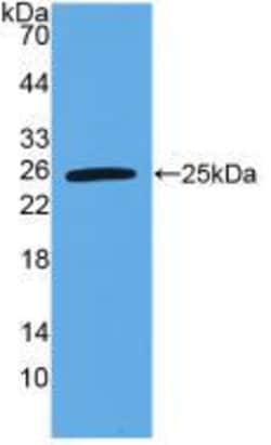 Invitrogen TL1A Polyclonal Antibody 200 &mu;L; Unconjugated:Antibodies,