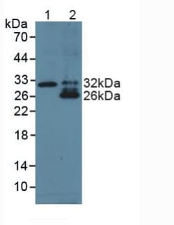 Invitrogen TL1A Polyclonal Antibody 200 &mu;L; Unconjugated:Antibodies,