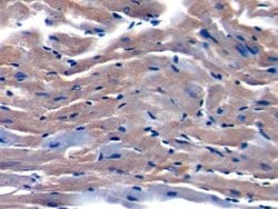 Invitrogen TOR2A Polyclonal Antibody 200 &mu;L; Unconjugated:Antibodies,