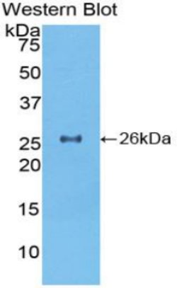 Invitrogen TOR2A Polyclonal Antibody 200 &mu;L; Unconjugated:Antibodies,