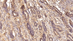 Invitrogen TGM2 Polyclonal Antibody 200 &mu;L; Unconjugated:Antibodies,
