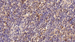 Invitrogen TGM2 Polyclonal Antibody 200 &mu;L; Unconjugated:Antibodies,