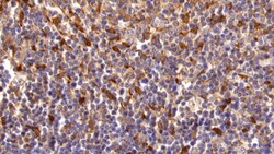 Invitrogen TGM2 Polyclonal Antibody 200 &mu;L; Unconjugated:Antibodies,