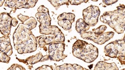 Invitrogen TGM2 Polyclonal Antibody 200 &mu;L; Unconjugated:Antibodies,