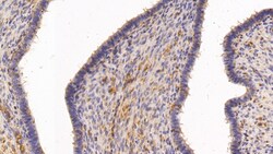 Invitrogen TGM2 Polyclonal Antibody 200 &mu;L; Unconjugated:Antibodies,