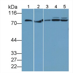 Invitrogen TGM2 Polyclonal Antibody 200 &mu;L; Unconjugated:Antibodies,
