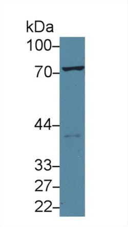 Invitrogen TGM2 Polyclonal Antibody:Antibodies:Primary Antibodies