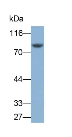 Invitrogen TGM2 Polyclonal Antibody 200 &mu;L; Unconjugated:Antibodies,