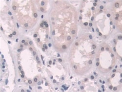 Invitrogen Transketolase Polyclonal Antibody 200 &mu;L; Unconjugated:Antibodies,