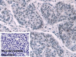 Invitrogen Transketolase Polyclonal Antibody 200 &mu;L; Unconjugated:Antibodies,
