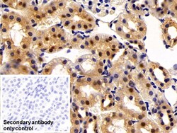Invitrogen Transketolase Polyclonal Antibody 200 &mu;L; Unconjugated:Antibodies,