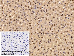 Invitrogen Transketolase Polyclonal Antibody 200 &mu;L; Unconjugated:Antibodies,