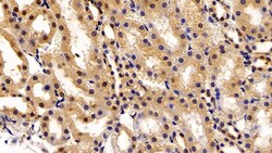 Invitrogen Transketolase Polyclonal Antibody 200 &mu;L; Unconjugated:Antibodies,