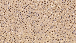 Invitrogen Transketolase Polyclonal Antibody 200 &mu;L; Unconjugated:Antibodies,