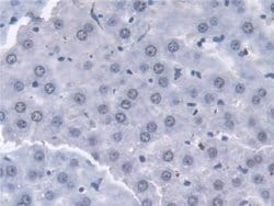 Invitrogen Transketolase Polyclonal Antibody 200 &mu;L; Unconjugated:Antibodies,
