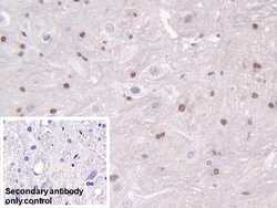 Invitrogen Transketolase Polyclonal Antibody 200 &mu;L; Unconjugated:Antibodies,