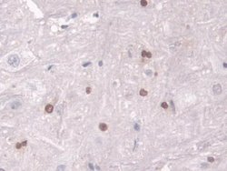 Invitrogen Transketolase Polyclonal Antibody 200 &mu;L; Unconjugated:Antibodies,