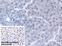Invitrogen Transketolase Polyclonal Antibody 200 &mu;L; Unconjugated:Antibodies,