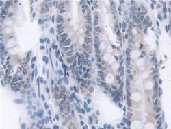 Invitrogen Transketolase Polyclonal Antibody 200 &mu;L; Unconjugated:Antibodies,