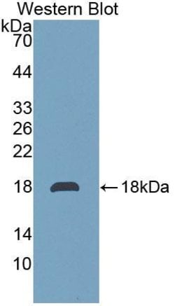 Invitrogen TMEM27 Polyclonal Antibody 20 &mu;L; Unconjugated:Antibodies,