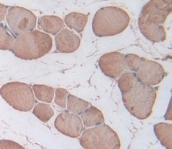 Invitrogen Triadin Polyclonal Antibody 200 &mu;L; Unconjugated:Antibodies,