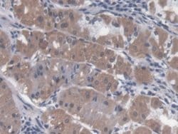 Invitrogen Trophinin Polyclonal Antibody 20 &mu;L; Unconjugated:Antibodies,