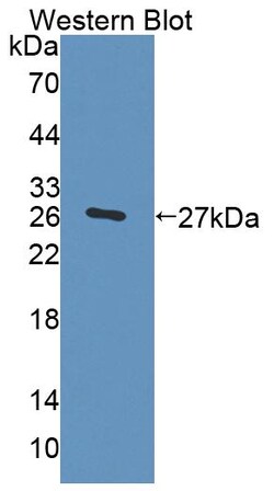 Invitrogen Trophinin Polyclonal Antibody 20 &mu;L; Unconjugated:Antibodies,