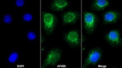 Invitrogen TPSB2 Polyclonal Antibody:Antibodies:Primary Antibodies