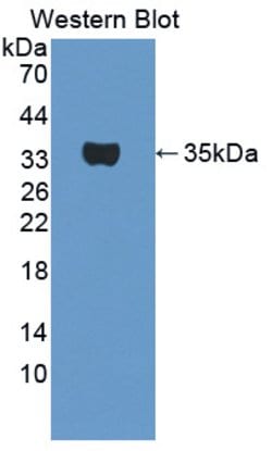 Invitrogen TPSB2 Polyclonal Antibody:Antibodies:Primary Antibodies