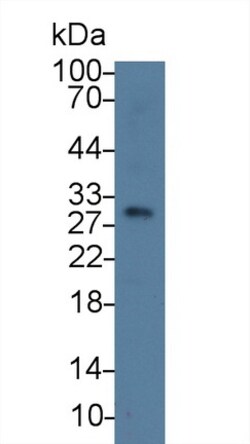 Invitrogen TPSB2 Polyclonal Antibody:Antibodies:Primary Antibodies
