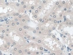 Invitrogen TPSB2 Polyclonal Antibody 200 &mu;L; Unconjugated:Antibodies,