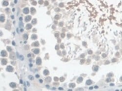 Invitrogen TPSB2 Polyclonal Antibody 200 &mu;L; Unconjugated:Antibodies,