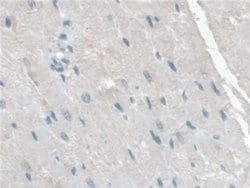 Invitrogen TPSB2 Polyclonal Antibody 200 &mu;L; Unconjugated:Antibodies,
