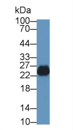 Invitrogen TPSB2 Polyclonal Antibody 200 &mu;L; Unconjugated:Antibodies,