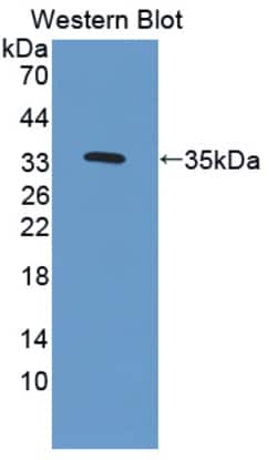 Invitrogen TPSB2 Polyclonal Antibody 200 &mu;L; Unconjugated:Antibodies,